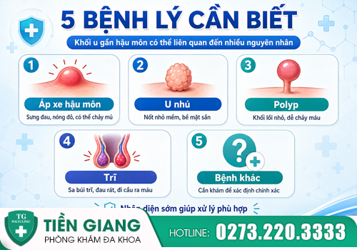 5 bệnh lý liên quan khối u hậu môn rất dễ gây nhầm lẫn