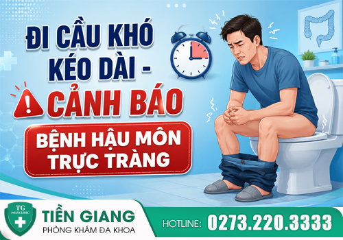 đi cầu khó kéo dài cảnh báo bệnh hậu môn trực tràng
