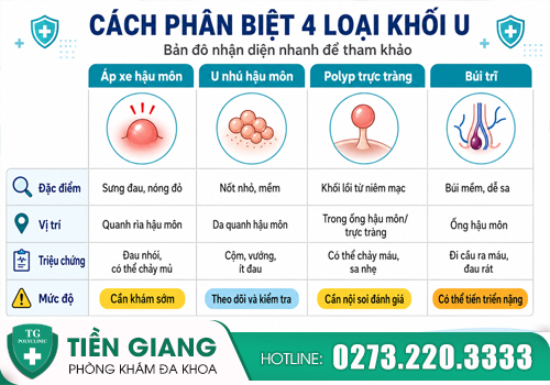 hướng dẫn phân biệt nhanh 4 loại khối u gần hậu môn